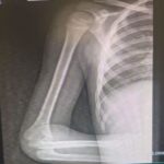 Criança de 4 anos luta contra doença agressiva e pai faz apelo por ajuda em Chapadão do Sul