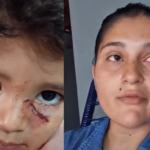 Menino de 3 anos é gravemente atacado por cachorro em praça de Aporé; mãe faz alerta